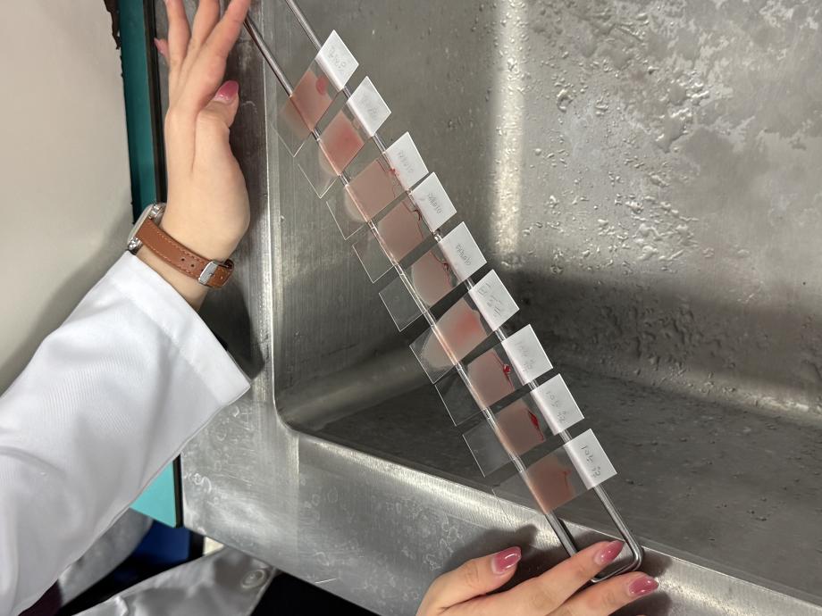 혈액도말표본 제작, Wright stain