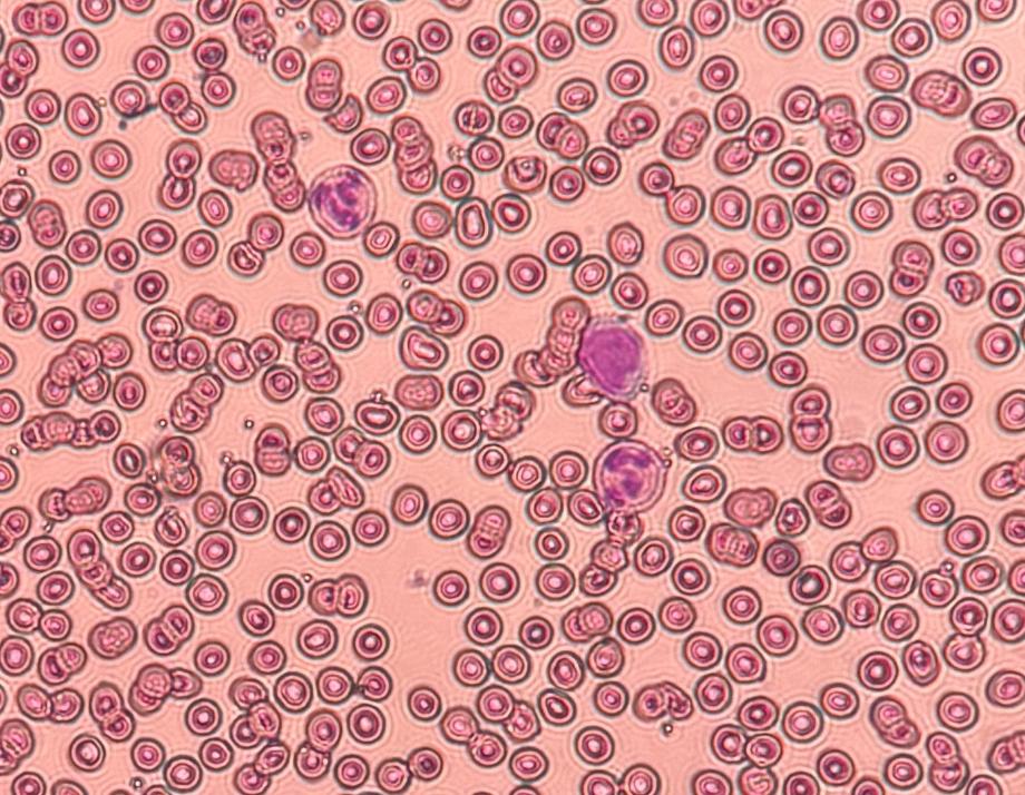 혈구 관찰, 그룹스터디